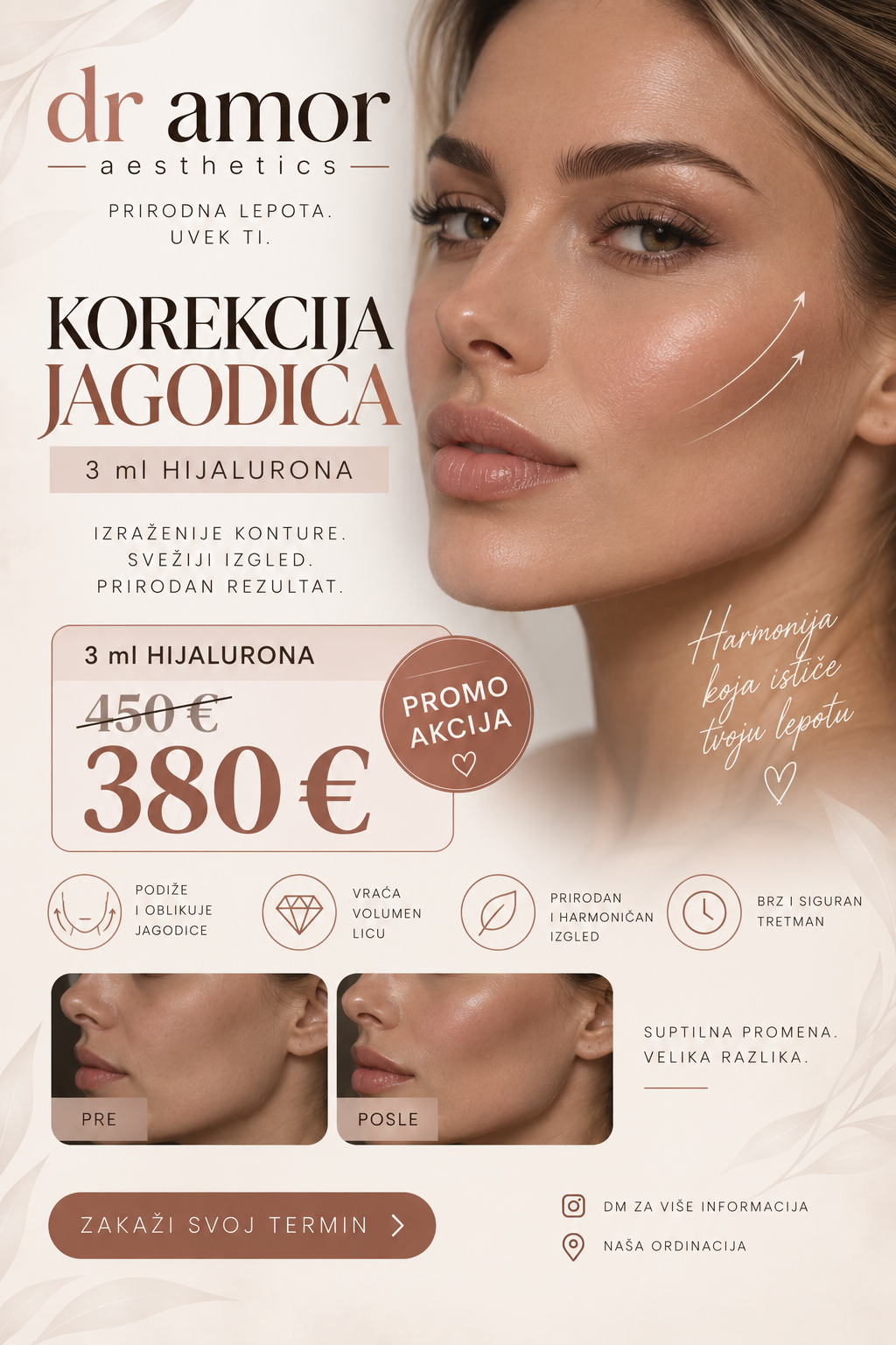 Korekcija jagodica hijaluronom